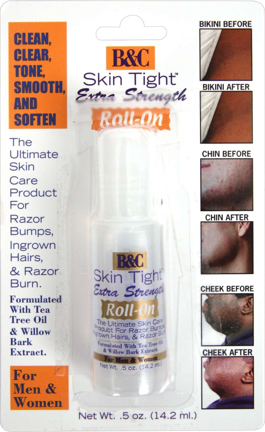 SKINTIGHT RAZOR BUMP ROLL ON [EXTRA] 0.5 OZ